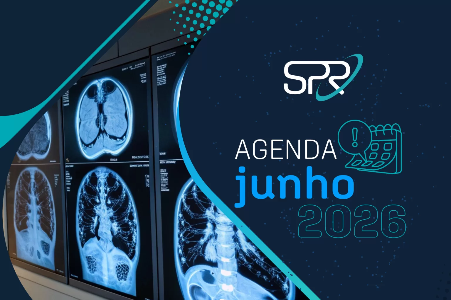 Junho na SPR
