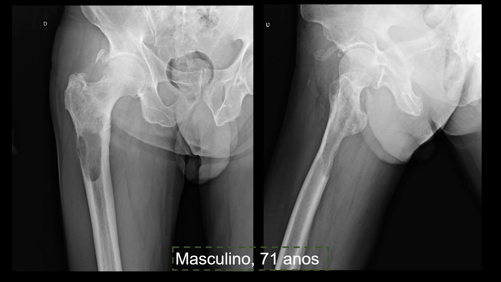 Musculoesquelético
