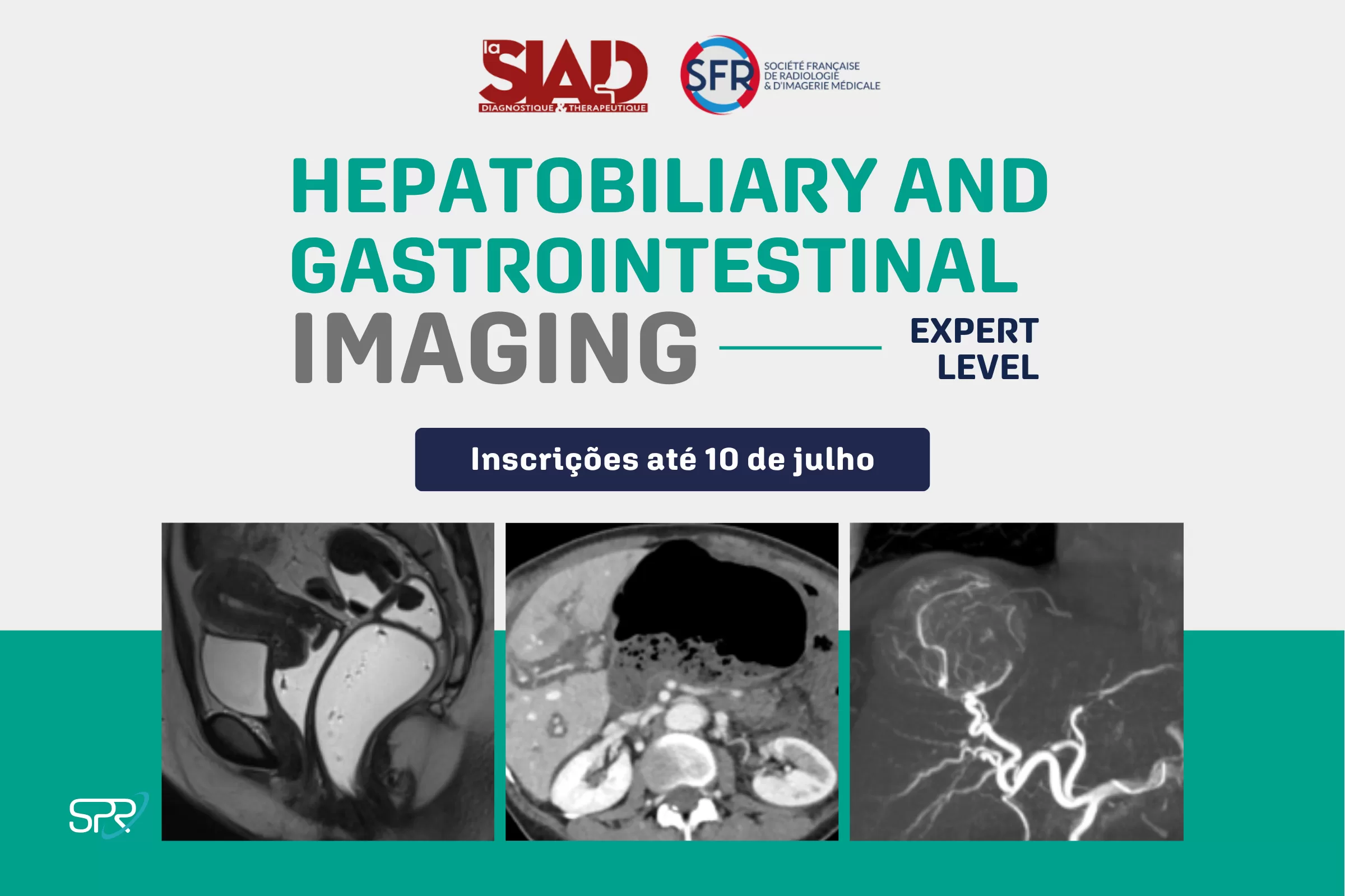 Curso Online SFR