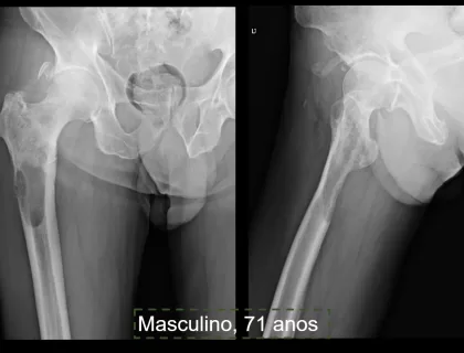 Musculoesquelético