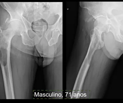 Musculoesquelético