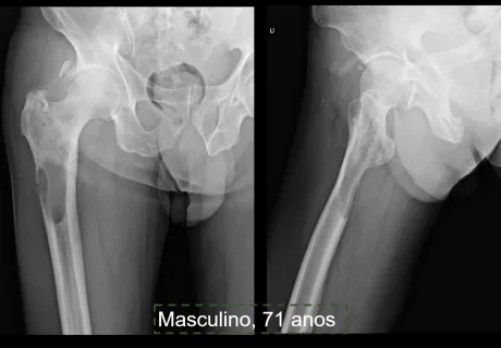 Musculoesquelético