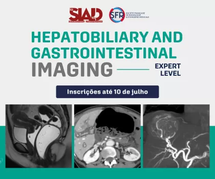 Curso Online SFR